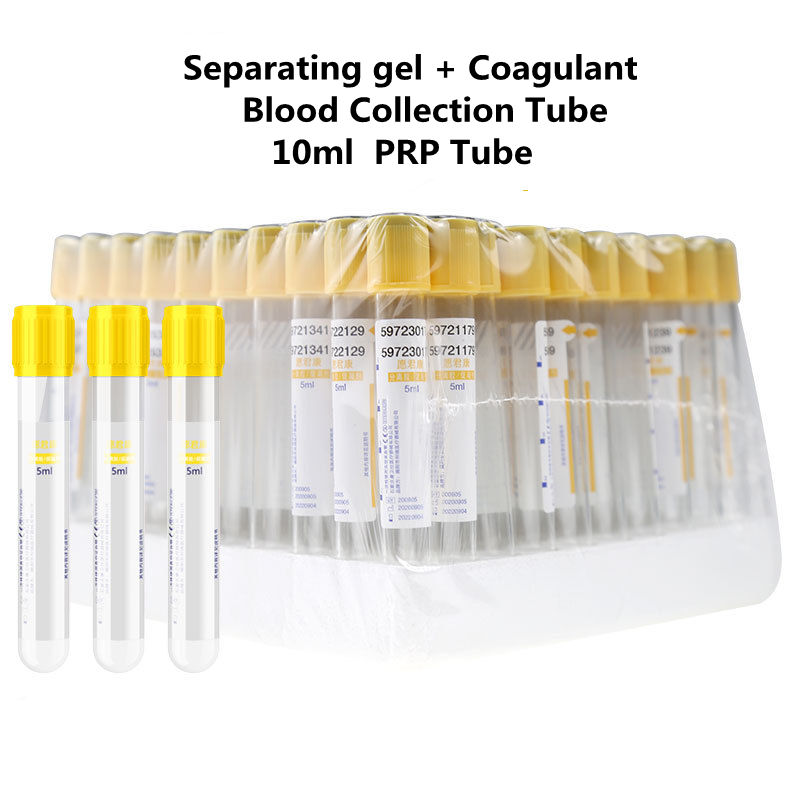 Medical Lab Blood Test - 使い捨て真空採血管 分離ゲルと凝固促進剤入り 黄色キャップ 血液検査管 検査室 PRPチューブ