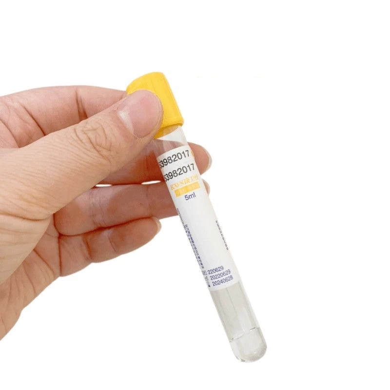 使い捨て真空採血管 分離ゲルと凝固促進剤入り 黄色キャップ  - Medical Lab Blood Test のレビューと価格